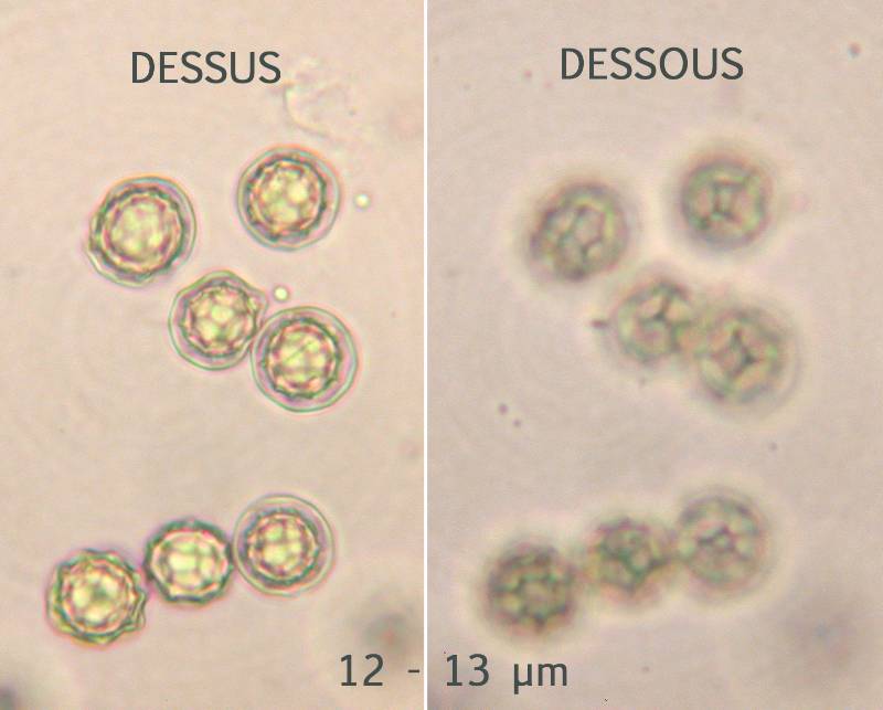 Spores Hydnangium-redim800.jpg