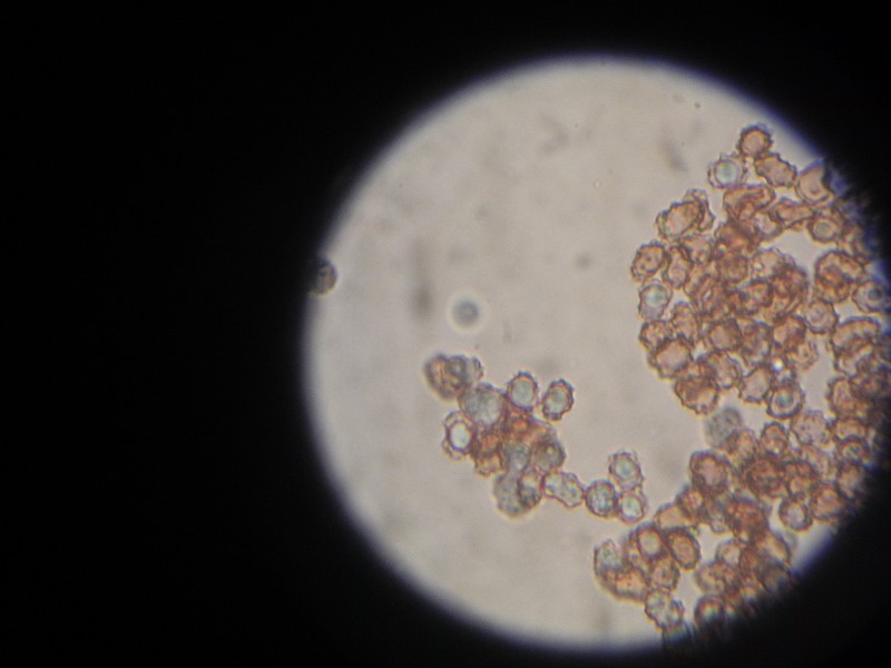 Trechispora3.JPG