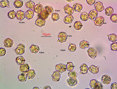 Spores Entoloma sp. x 1000-eau.jpg