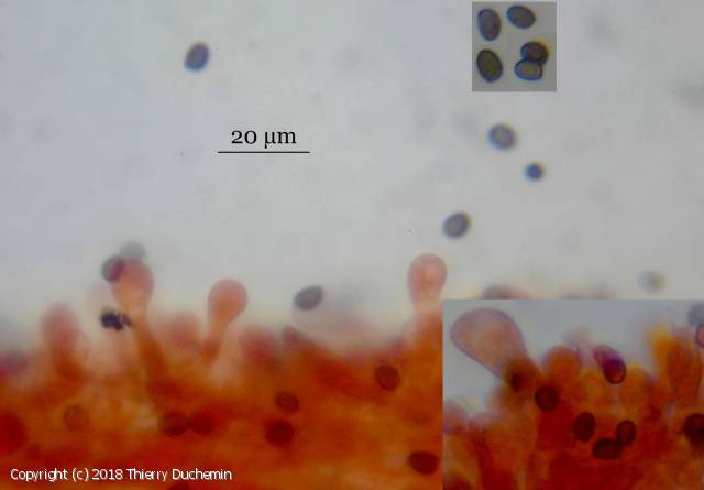 Agaricus moellerianus (Agaricus_moellerianus_2018_td_3.jpg)