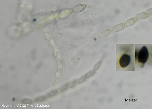 Biscogniauxia anceps (Biscogniauxia_anceps_2025_td_5.jpg)